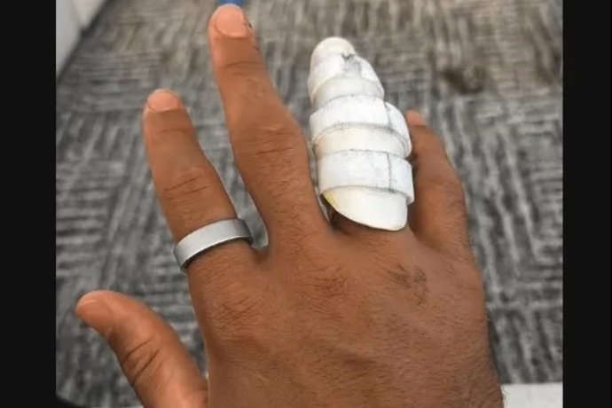 哈特曬術后無名指護具照,湖人后衛線恢復進程引關注 哈特曬術后無名指護具照,湖人后衛線恢復進程引關注